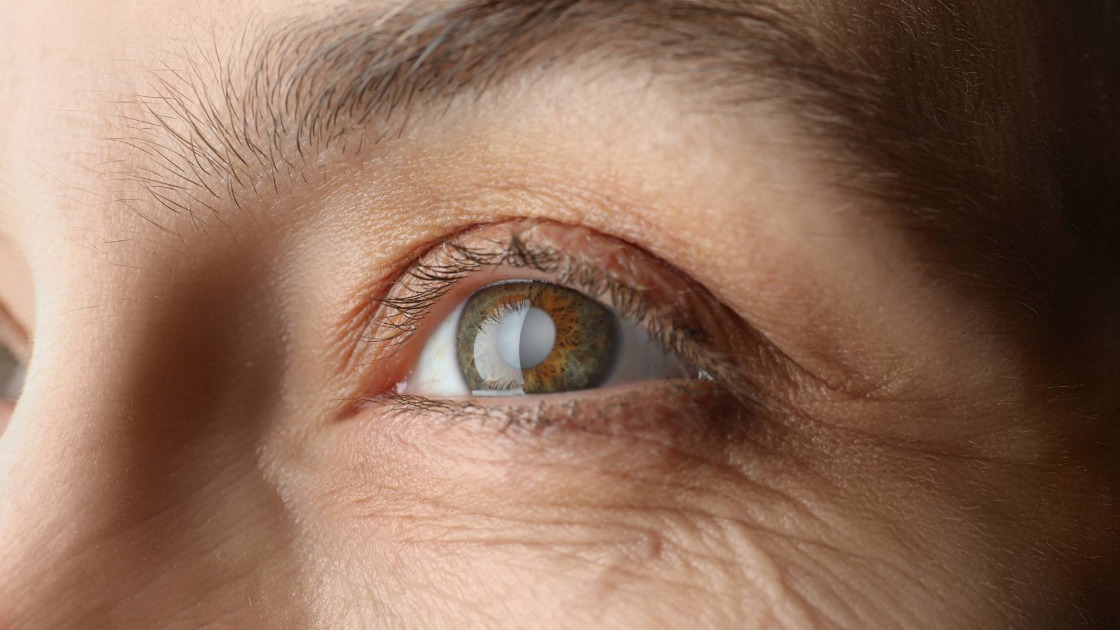 campanha-maio-verde-chama-atencao-para-o-risco-invisivel-do-glaucoma