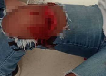 Briga entre adolescentes termina com estudante gravemente ferida por lâmina dentro de escola