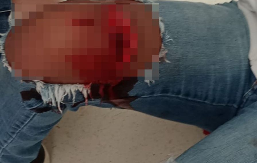 Briga entre adolescentes termina com estudante gravemente ferida por lâmina dentro de escola