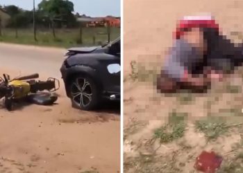 Motoboy fica ferido após grave acidente com carro na Baixada Campista