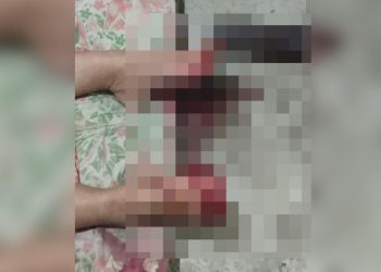 Morre mulher que teve dedos decepados pela filha em Itaperuna